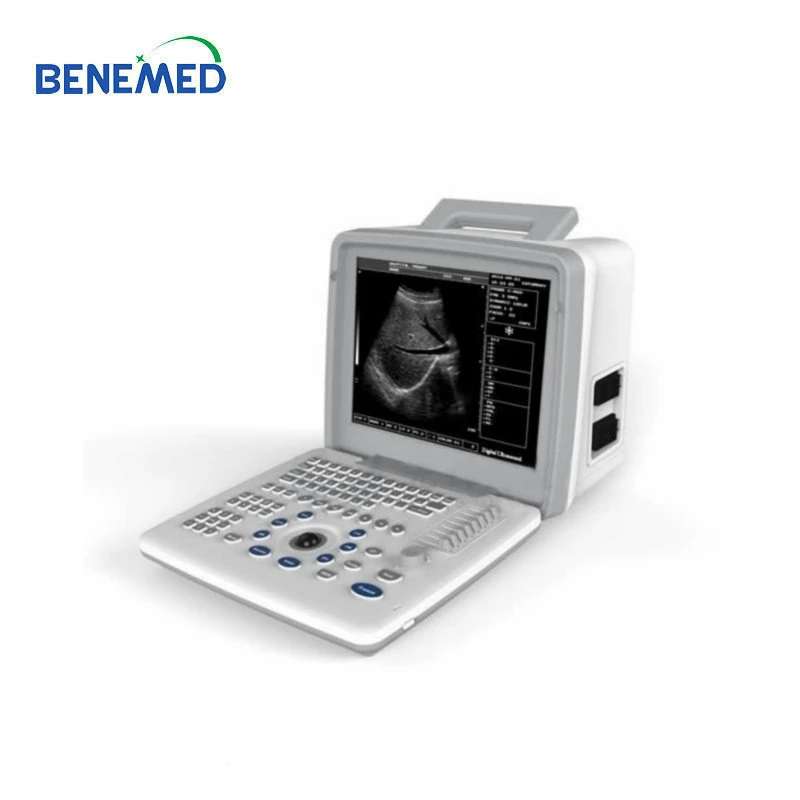 Portable B/W Ultrasound Scanner with Clear Image Quality