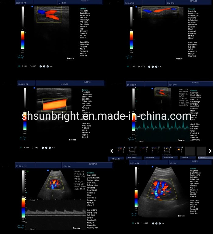 Clinic Diagnostic Cheap 4D Trolley Color Doppler Ultrasound Scanner Echo Scanner