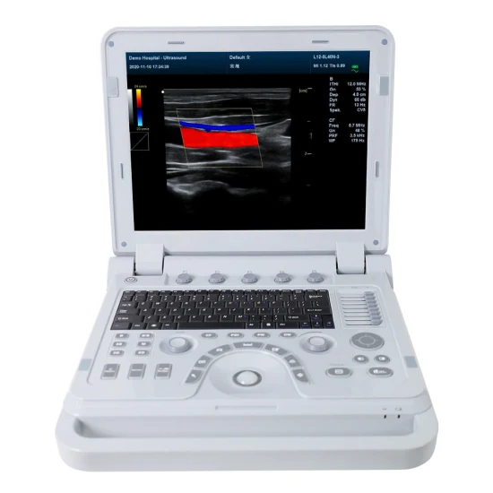 Contec Hospital Equipment Farbdoppler-Ultraschall-Diagnosesystem