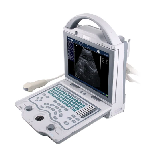 Langlebiger/funktionaler/kostengünstiger S/W-Ultraschallscanner für den Menschen (KX5600)