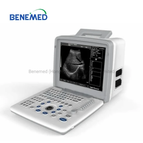 Tragbarer Schwarzweiß-Ultraschallscanner mit klarer Bildqualität